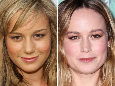 Brie Larson Plastic Surgery